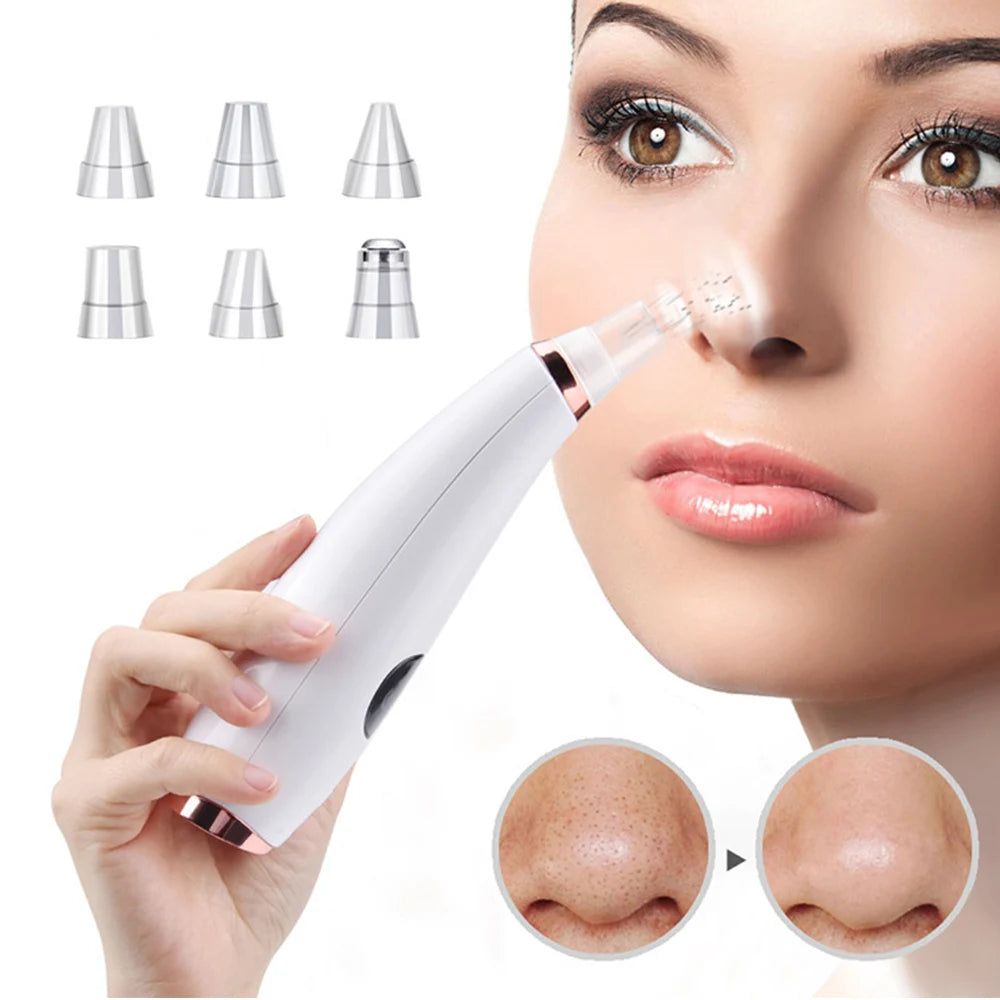 Electric Blackhead Remover Vacuum Acne Cleaner Black Spots Removal Facial Deep Cleansing Pore Cleaner Machine Skin Care Tools